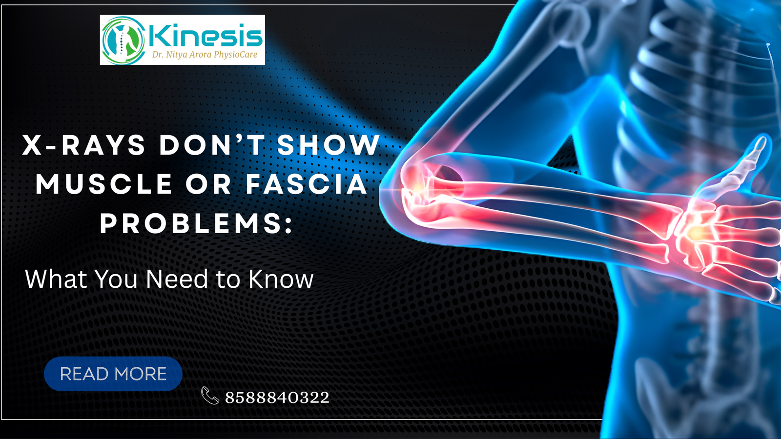 X-Rays Don’t Show Muscle or Fascia Problems: What You Need to Know